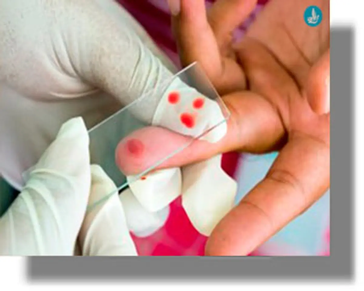 Ο «εφιάλτης» της ελονοσίας ξύπνησε στο νησί της Κω