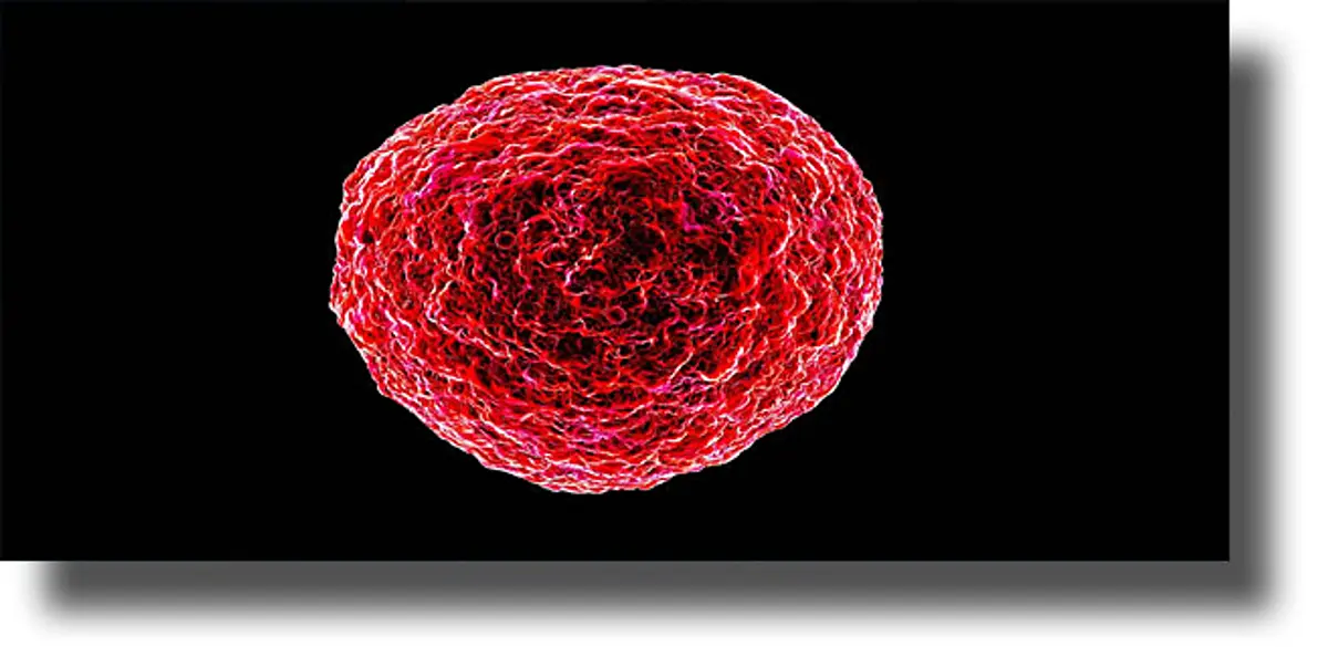 O «ξάδελφος» του HIV που μαστίζει την Αυστραλία