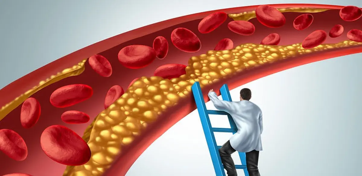 Στένωση αρτηριών: Τι να τρώτε και τι να αποφεύγετε