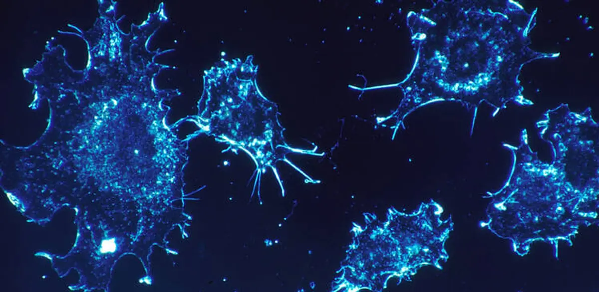 Ολοκληρωμένη θεραπεία για τον καρκίνο μέσα στο 2020 «υπόσχονται» επιστήμονες