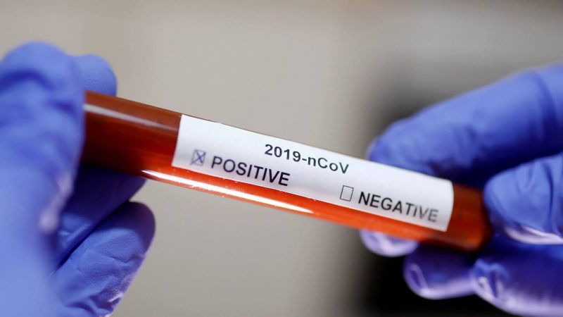 Λέρος: Αρνητικά όλα τα test ταχείας ανίχνευσης Κορωνοϊού σε Δήμο και ΚΥΤ